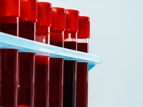 Blood Work 101: What Your Blood Tests Reveal at Different Ages
