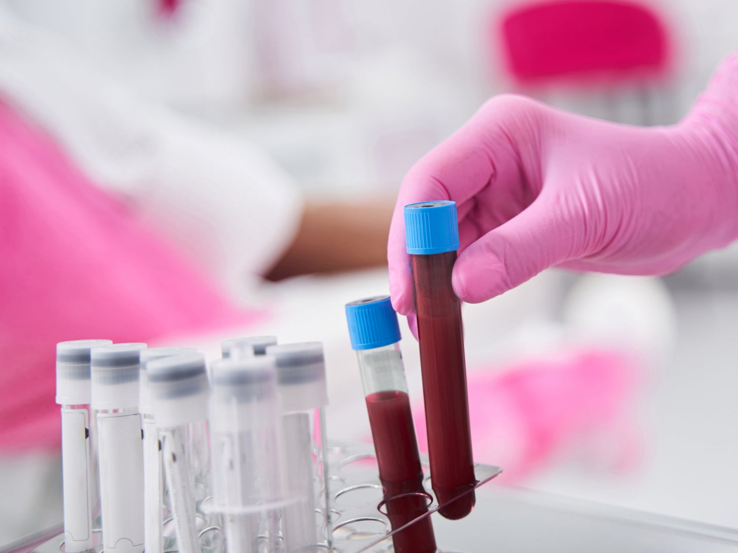 What Is the Difference Between Hematocrit and Hemoglobin?