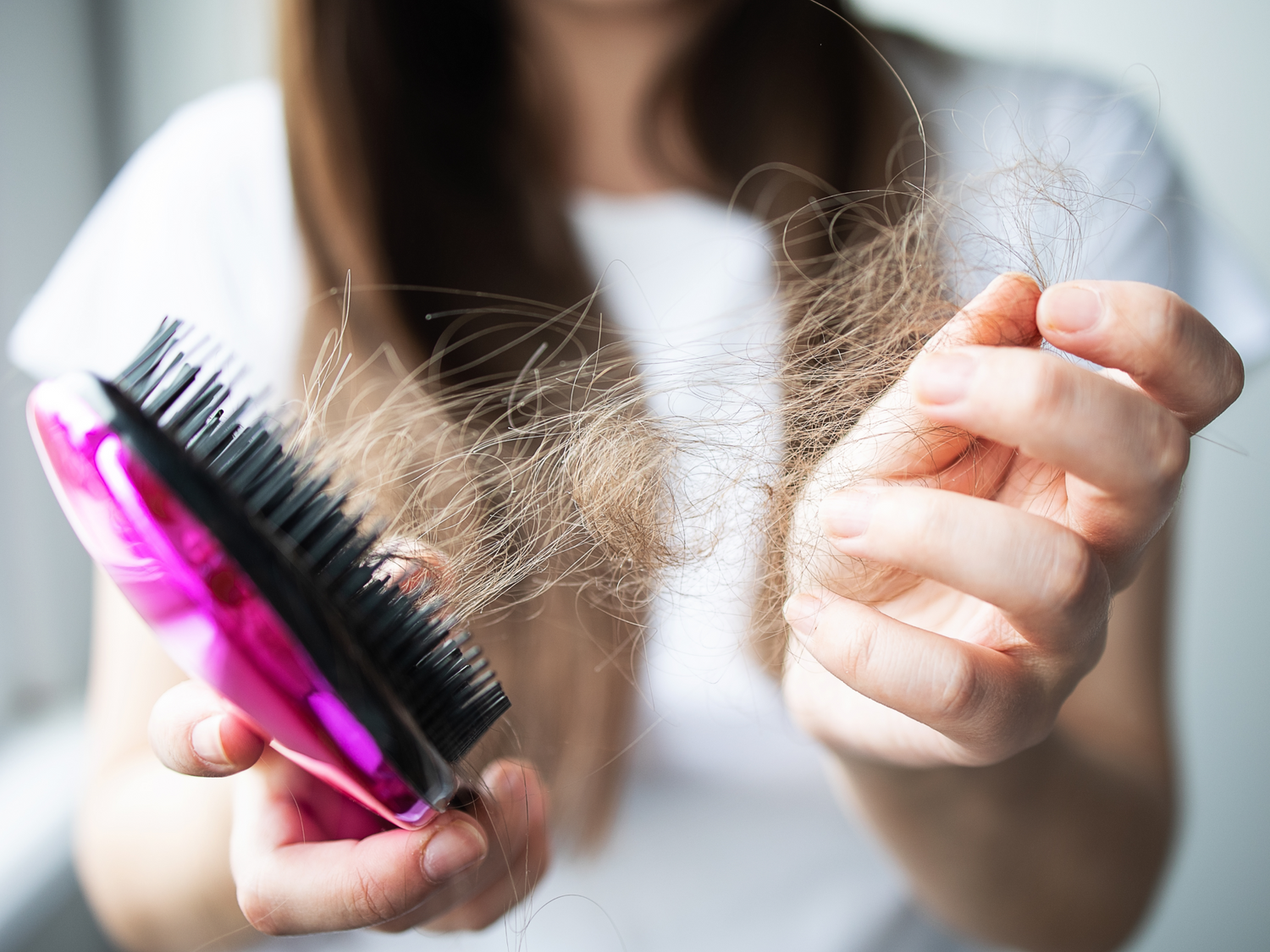 The Hidden Connection: How Weight Loss Can Trigger Hair Loss