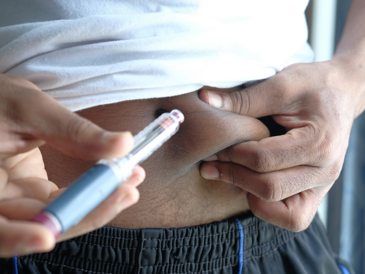 Weight Loss Trends – Are They Causing Anemia?