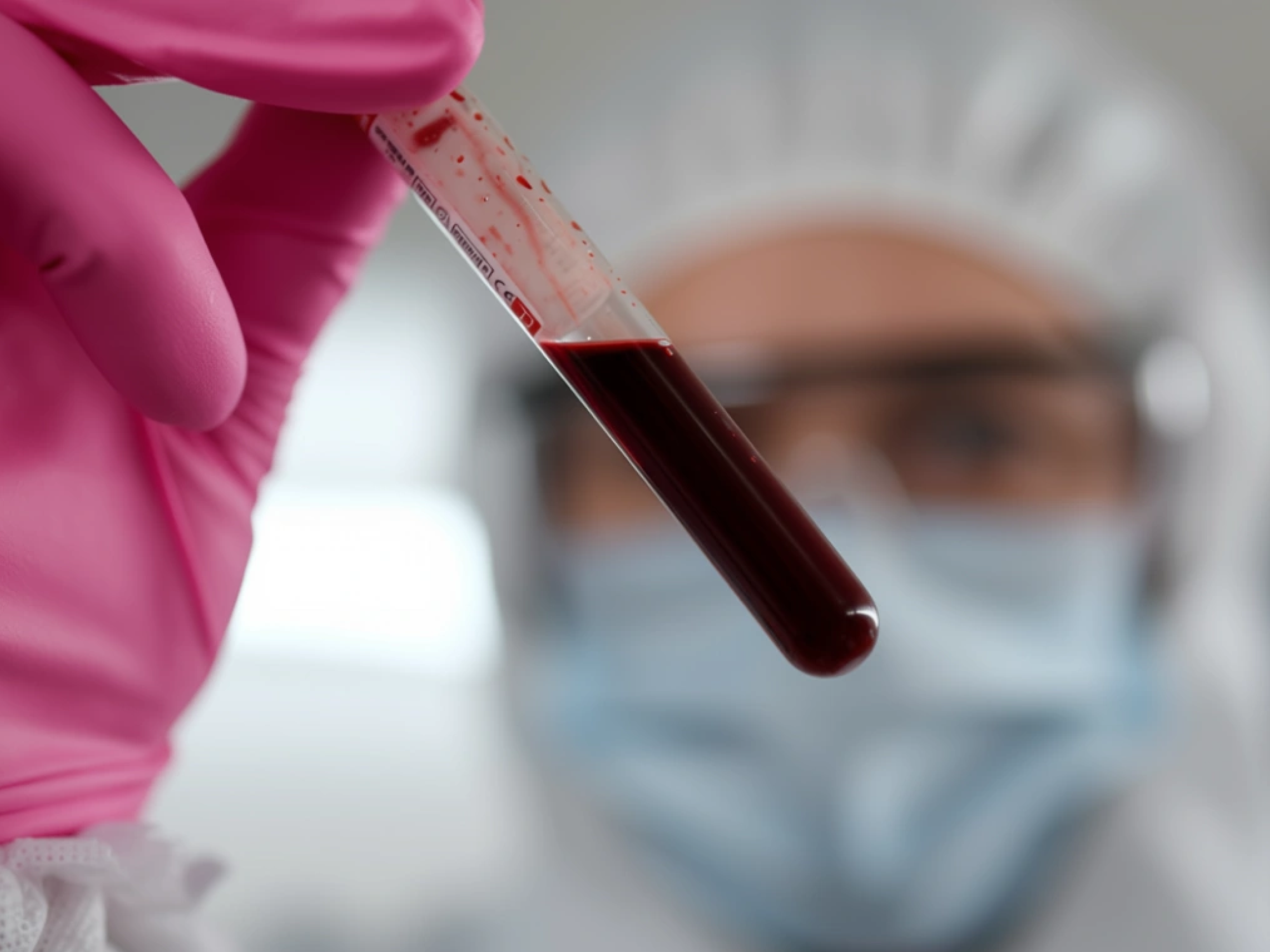 2025 Year in Blood Health: Top Discoveries, Habits, and Tips