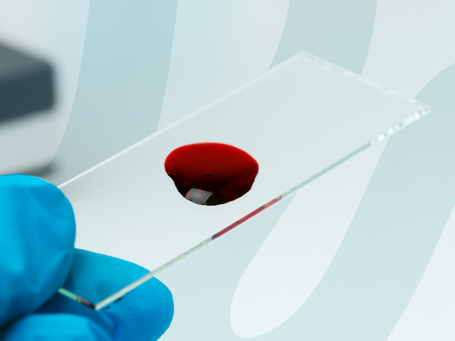 What is Polycythemia? A Comprehensive Guide