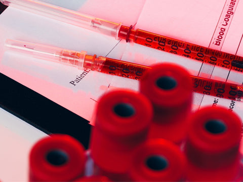 Understanding Lab Results: What Your Annual Physical Blood Work Can Tell You